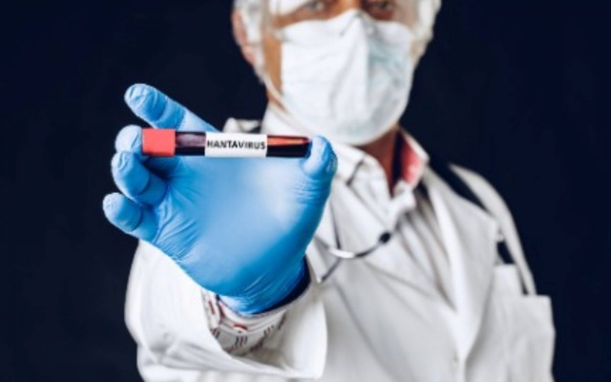 Hantavírus: diagnóstico precoce ajuda a diferenciar doença de outras infecções febris e ampliar cuidado adequado