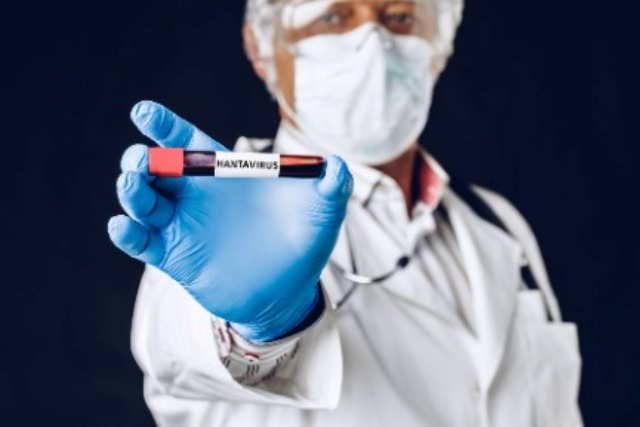 Hantavírus: diagnóstico precoce ajuda a diferenciar doença de outras infecções febris e ampliar cuidado adequado